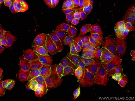beta catenin antibody|Anti.